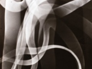 thmb-jaroslav-rossler-1902-1990-svetelne-studie-1924-lifetime-gelatin-silver-print-247-x-231-cm-3336.jpg